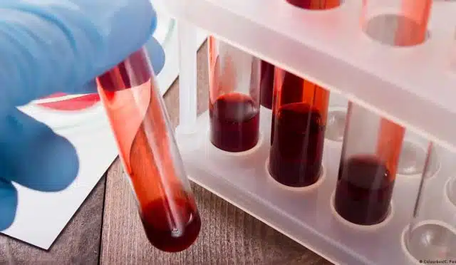 kan testleri ve değerleri