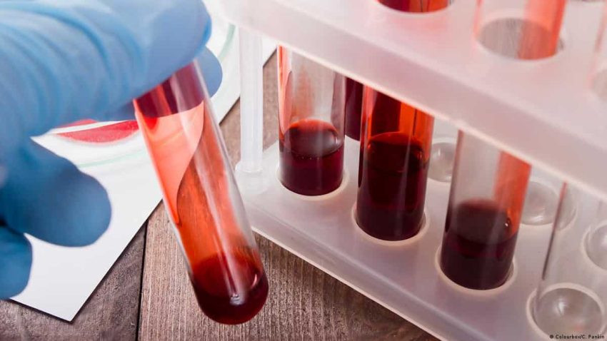 Kan Testleri Türleri Nelerdir?